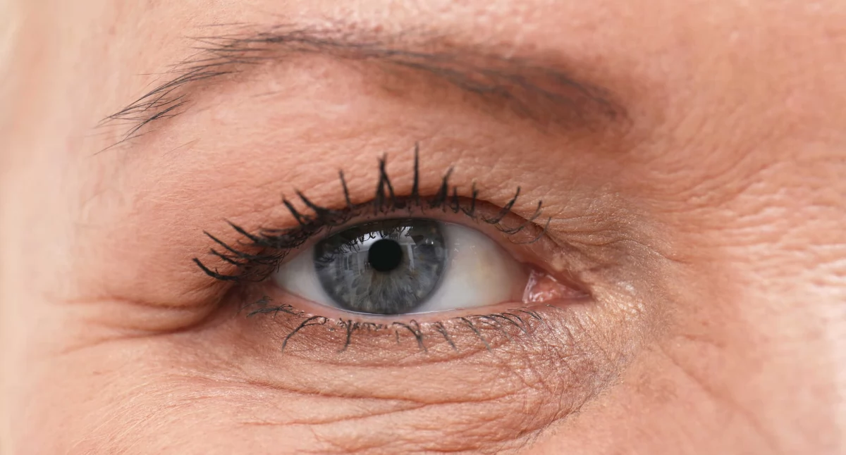 Zdrowie, gradówka zaraźliwa Fakty infekcjach - zdjęcie, fotografia