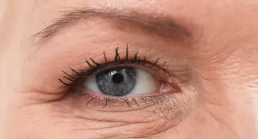 Czy gradówka jest zaraźliwa? Fakty i mity o infekcjach oka