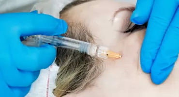 U kogo botoks i zabiegi laserowe?