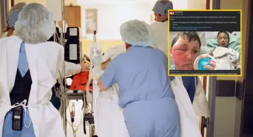 Prawa strona twarzy praktycznie się topiła! Alarm wokół znanej zabawki